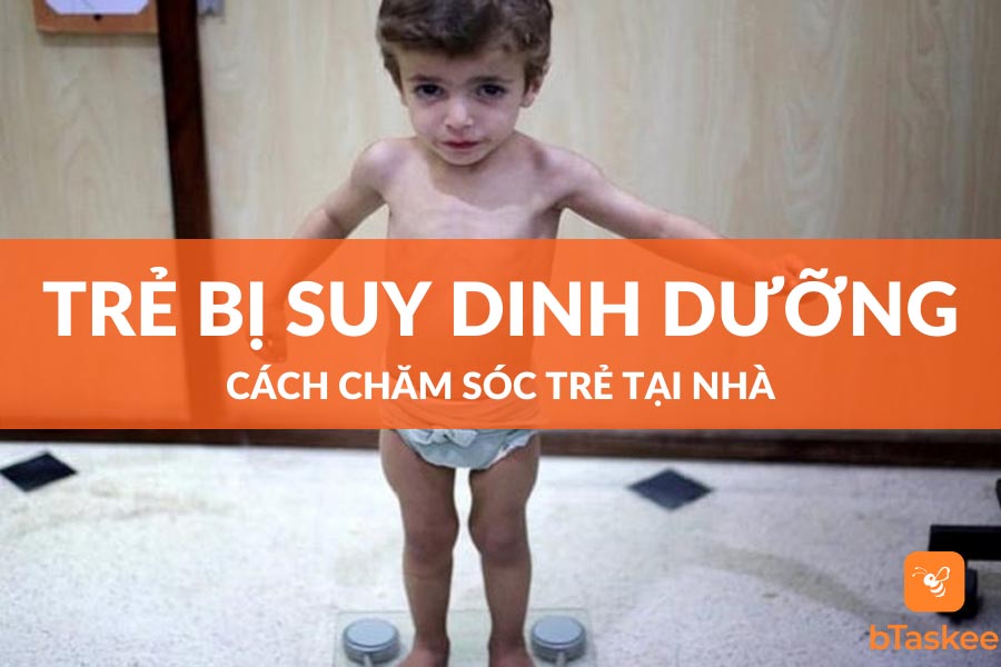 Cách Chăm Sóc Trẻ Bị Suy Dinh Dưỡng Khoa Học Nhất