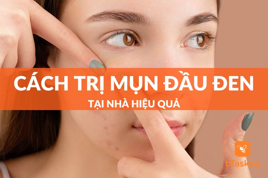 Cách Trị Mụn Đầu Đen Ở Mũi Hiệu Quả, Đơn Giản Tại Nhà