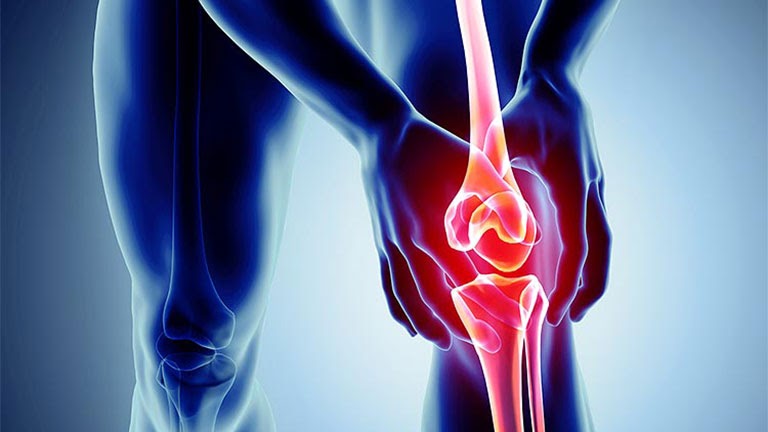 Thoái Hóa Khớp Là Gì? Nguyên Nhân Và Cách Phòng Ngừa