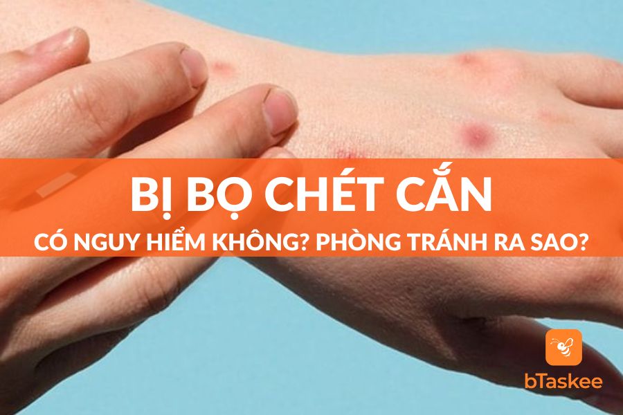 Bị Bọ Chén Cắn: Nguyên Hiểm Tiềm Tàng Và Cách Phòng Tránh