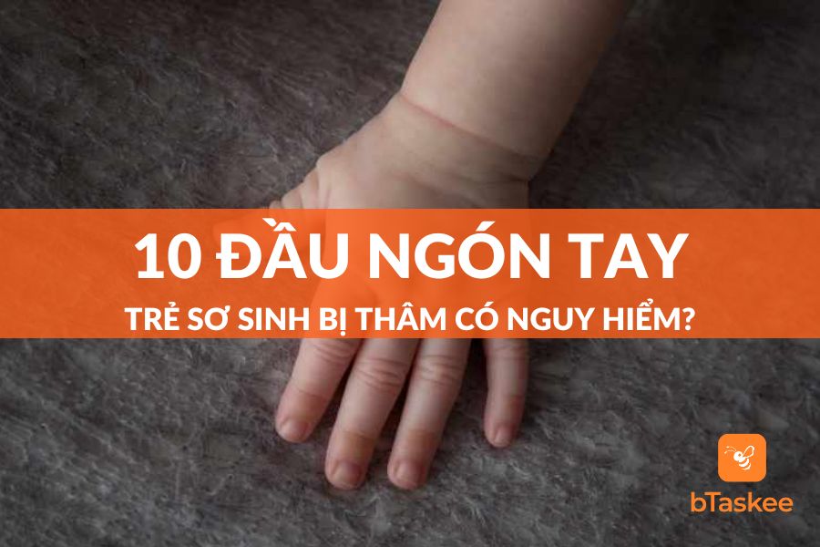 [Giải Đáp] 10 Đầu Ngón Tay Trẻ Sơ Sinh Bị Thâm Có Nguy Hiểm?